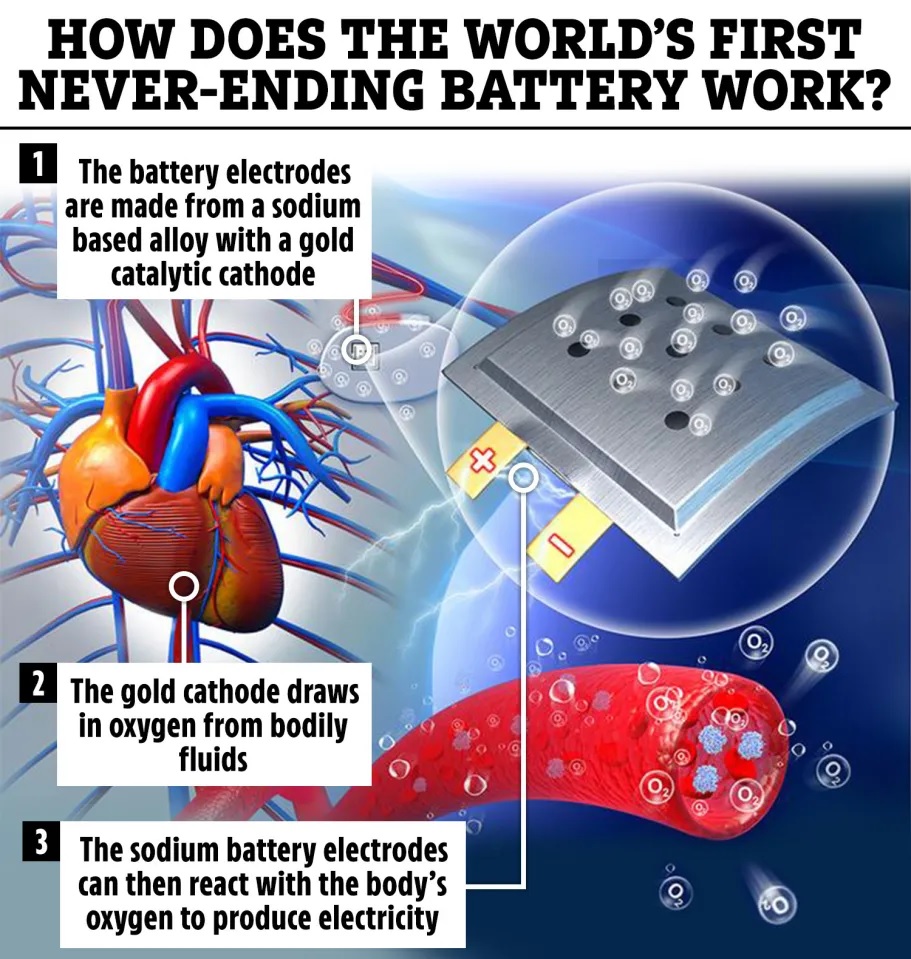 Κίνα Μπαταρία 