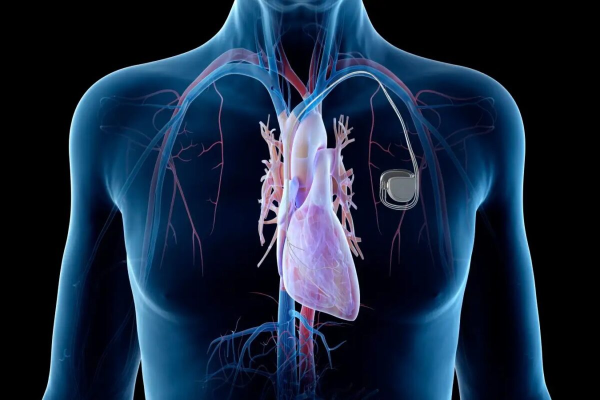 βηματοδότης