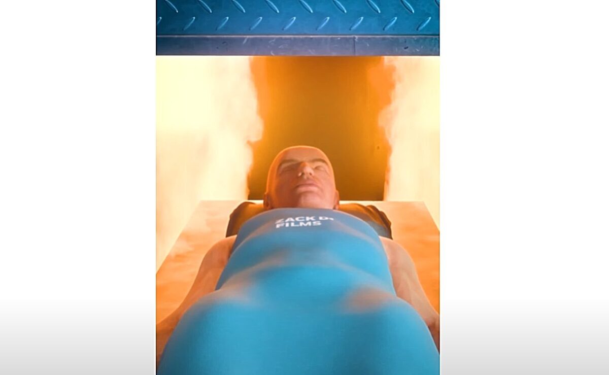 καύση σώματος