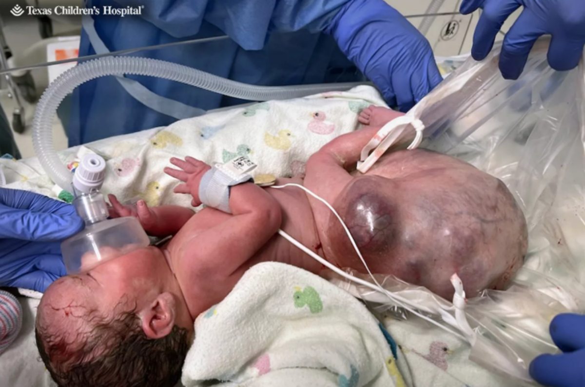 Texas Children's Hospital