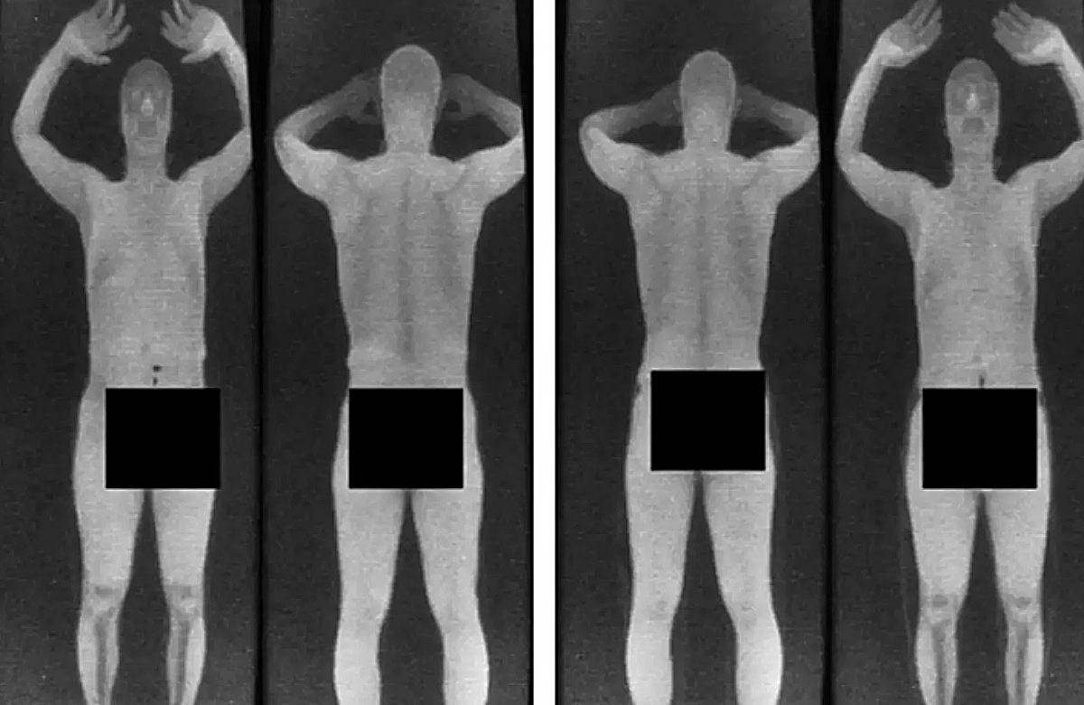 X Ray, αεροδρόμια