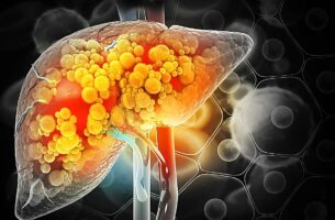 Συκώτι: Γιατρός παρουσιάζει 4 απλά τεστ που μπορείς να κάνεις στο σπίτι για να ελέγξεις την υγεία του