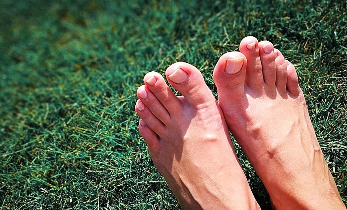 δάκτυλο, Morton΄s foot