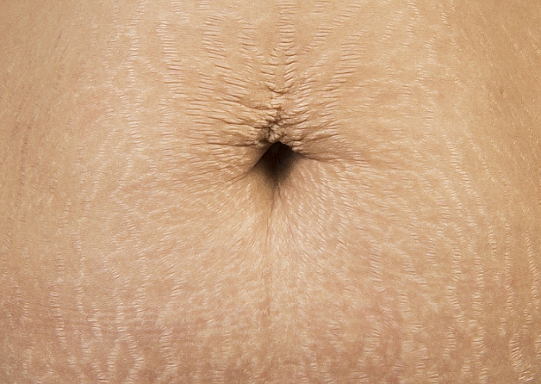 μαύρη γραμμή, κοιλιά, linea nigra