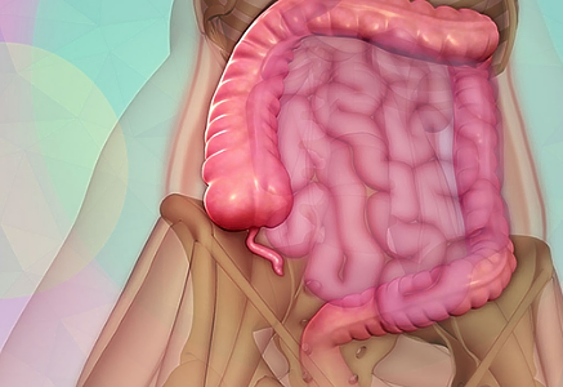 καρκίνος, σκωληκοειδής απόφυση