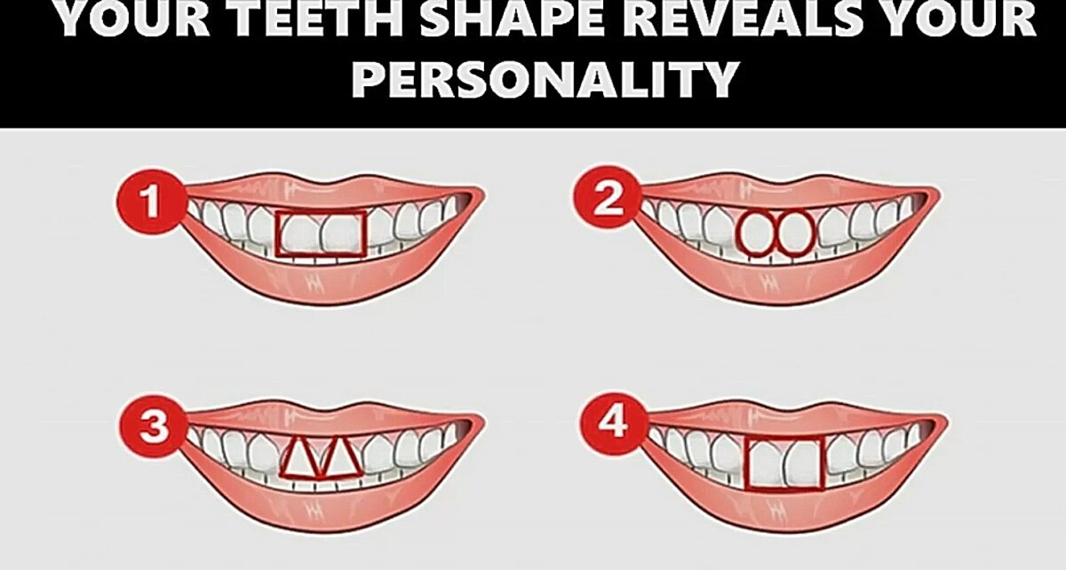 τεστ, εικόνα