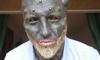 Anthony Loffredo: Ο άνδρας που βρίσκεται στο 71% της «μεταμόρφωσης σε μαύρο εξωγήινο» και προκαλεί δέος