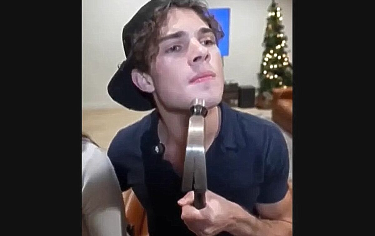 Η επικίνδυνη τάση του «bone-smashing»: Γιατί το να χτυπάς το πρόσωπό σου με σφυρί είναι ιατρικός εφιάλτης