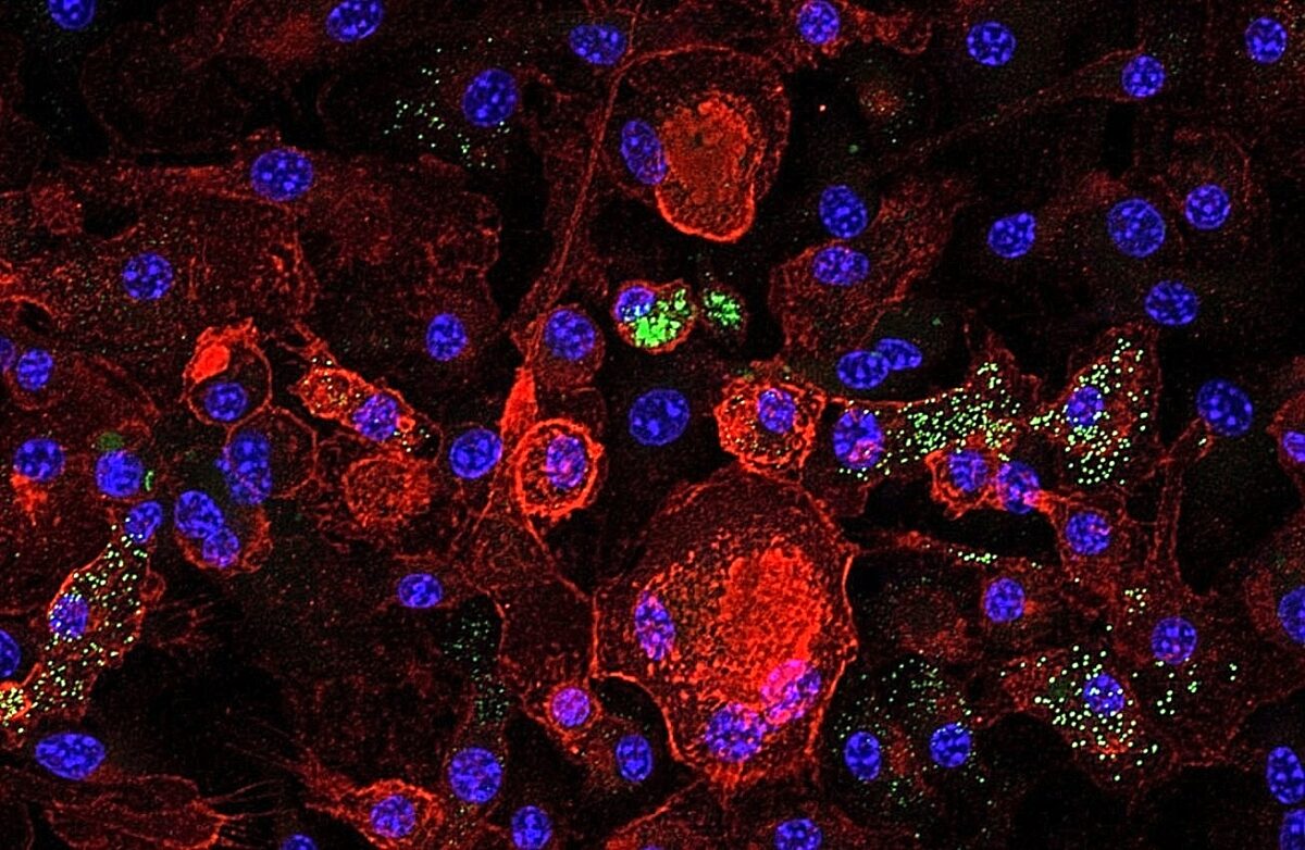 Επιστήμονες απομακρύνουν κύτταρα «ζόμπι» και αναστρέφουν την ηπατική βλάβη σε ποντίκια