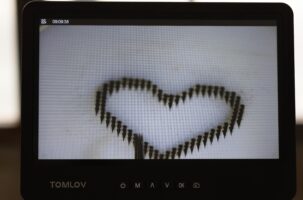 Μόνιμο τατουάζ χωρίς βελόνες; Νέα τεχνολογία υπόσχεται ανώδυνη εφαρμογή με μικροβελόνες